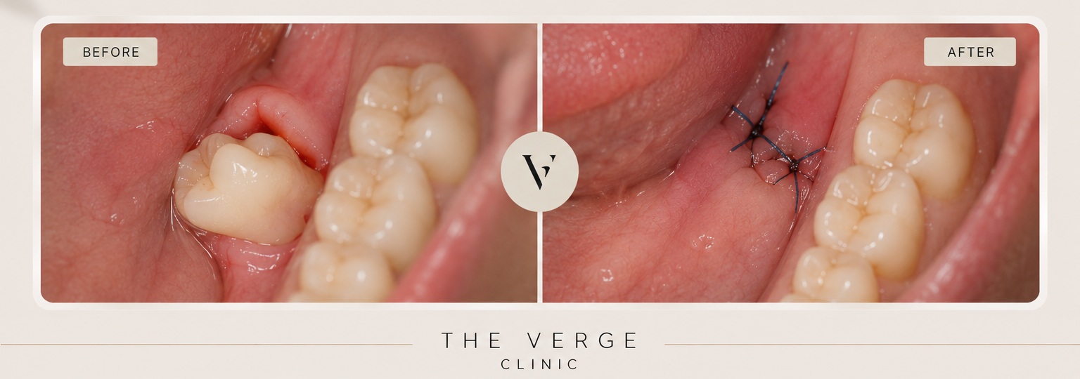 Oral surgery at The Verge Clinic